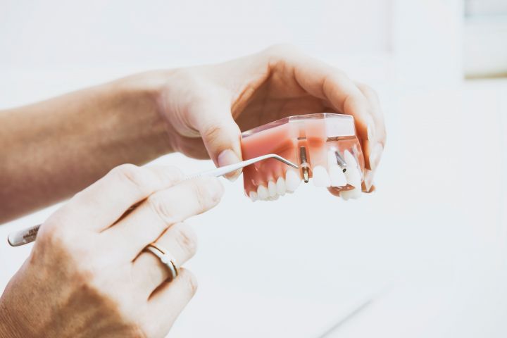 Best Dentists in San Jose California
